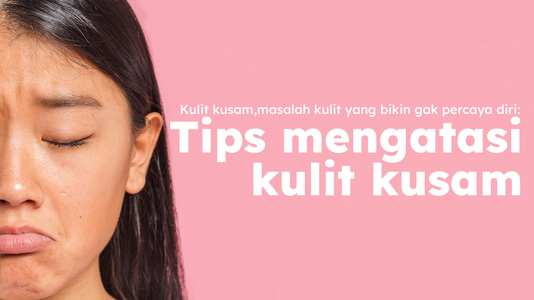 Kulit kusam, masalah kulit yang bikin gak percaya diri: Tips mengatasi kulit kusam