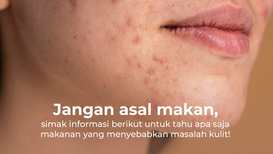 Jangan asal makan, simak informasi berikut untuk tahu apa saja makanan yang menyebabkan masalah kulit!